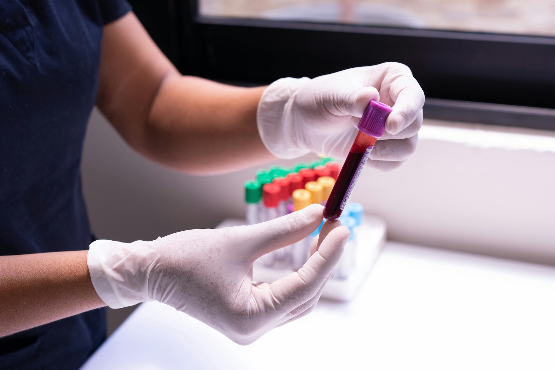 background image for Routine Bloodwork