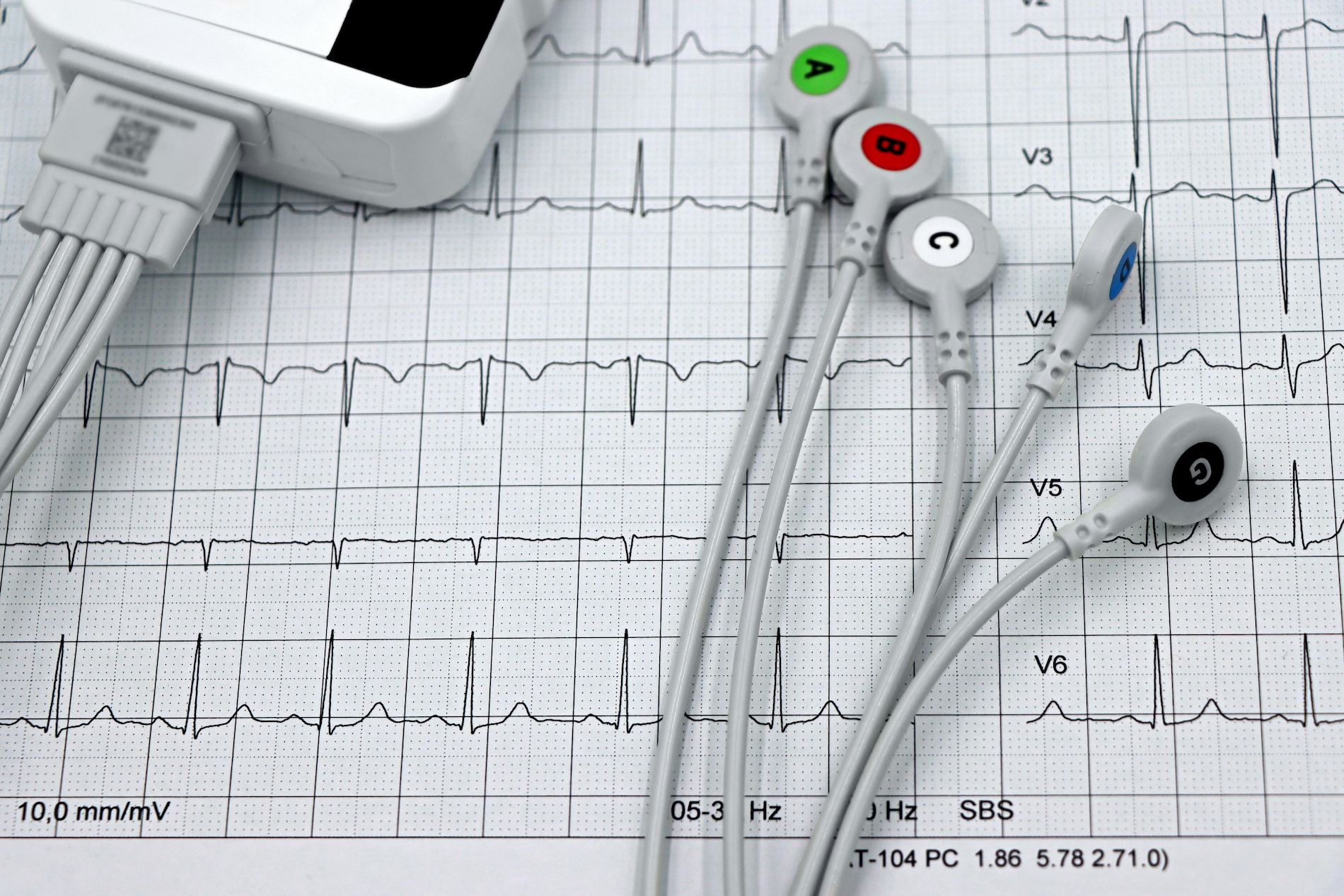 background image for EKG Screenings